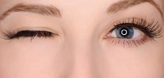 س و ج.. كل ما تريد معرفته عن انسداد القناة الدمعية