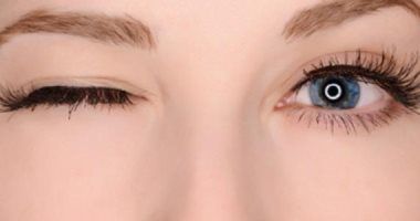 س و ج.. كل ما تريد معرفته عن انسداد القناة الدمعية