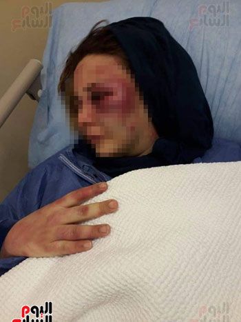 زوج يعذب زوجته 3 أيام متواصلة بأسلاك الكهرباء والسكين بسبب الشك.. الزوجة: "وقفت ضد أهلى عشان...