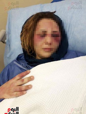 زوج يعذب زوجته 3 أيام متواصلة بأسلاك الكهرباء والسكين بسبب الشك.. الزوجة: "وقفت ضد أهلى عشان...