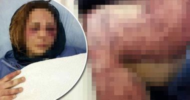 زوج يعذب زوجته 3 أيام متواصلة بأسلاك الكهرباء والسكين بسبب الشك.. الزوجة: "وقفت ضد أهلى عشان...