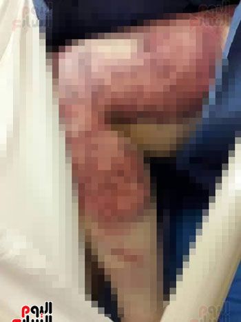 زوج يعذب زوجته 3 أيام متواصلة بأسلاك الكهرباء والسكين بسبب الشك.. الزوجة: "وقفت ضد أهلى عشان...