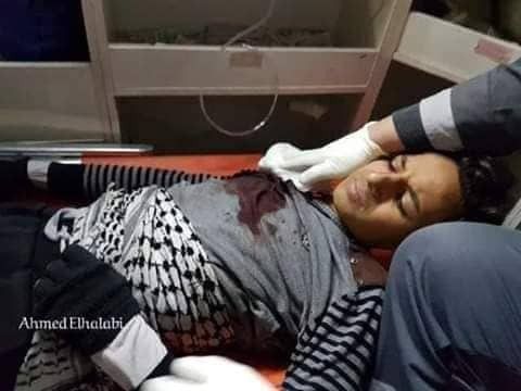 بالصور: إصابة نجل الشيخ أحمد ياسين خلال فعاليات الارباك الليلي