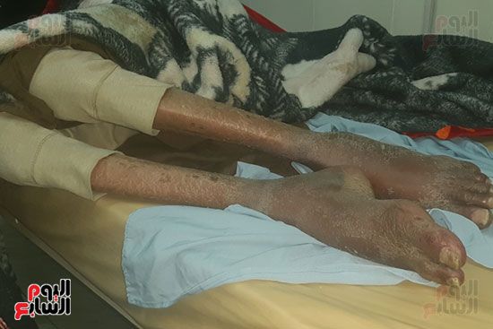 "اليوم السابع" يلتقى ضحية الميراث بأسيوط.. محمد على: طالبت شقيقى الأكبر بنصيبى فحبسنى 9...