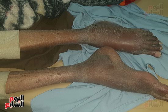 "اليوم السابع" يلتقى ضحية الميراث بأسيوط.. محمد على: طالبت شقيقى الأكبر بنصيبى فحبسنى 9...