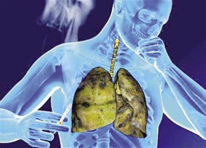 تحذير للسعوديين والمقيمين... مرض "قاتل" يختبئ في المكيفات سيقضي عليك وعلى أفراد عائلتك