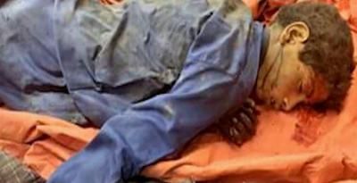 أخبار اليمن : تعرف على جرائم العدوان في مثل هذا اليوم