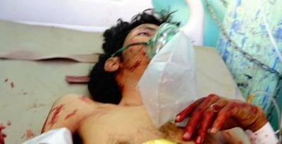 أخبار اليمن : جرائم العدوان في مثل هذا اليوم 2 أكتوبر