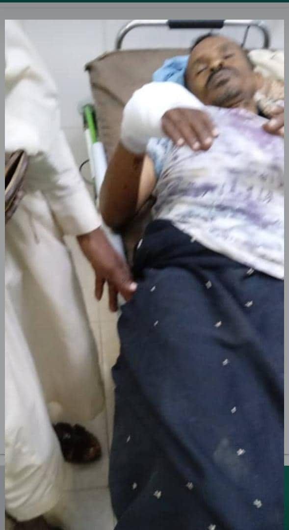 حيوان مفترس يُهاجم أسرة يمنية في المحويت لتحدث مفاجأة في النهاية (صور)