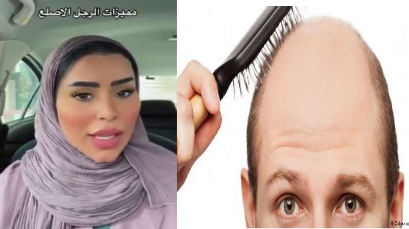 اتفرج مشهورة سعودية تعبر عن إعجابها بالرجل الأصلع لسبب صادم لا يخطر على البال