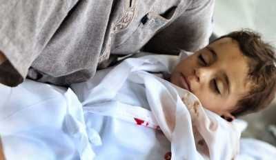 أخبار اليمن : إرتفاع عدد شهداء غزة إلى 704 بينهم 140 طفلاً