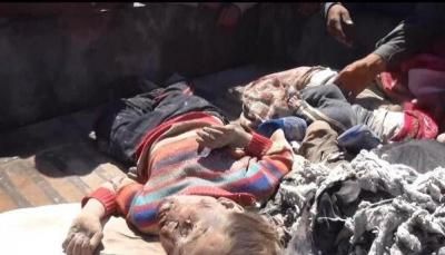 أخبار اليمن : جرائم العدوان في مثل هذا اليوم 15 أكتوبر