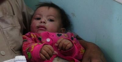 أخبار اليمن : جرائم العدوان في مثل هذا اليوم 23 أكتوبر