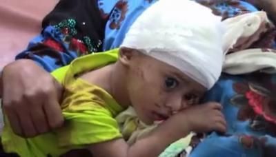 أخبار اليمن : جرائم العدوان في مثل هذا اليوم 26 أكتوبر