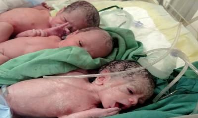 أخبار اليمن : ولادة ثلاثة توائم في مستشفى الكويت الجامعي