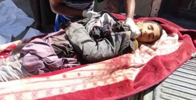 أخبار اليمن : جرائم العدوان في مثل هذا اليوم 18 نوفمبر