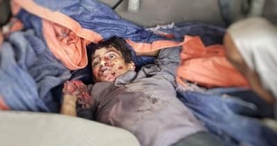 أخبار اليمن : مخلفات الحرب تقتل وتصيب 21 مدنياً في شهر