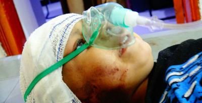 أخبار اليمن : جرائم العدوان في مثل هذا اليوم 8 يناير