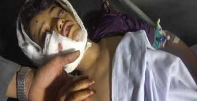 أخبار اليمن : جرائم العدوان في مثل هذا اليوم 9 يناير