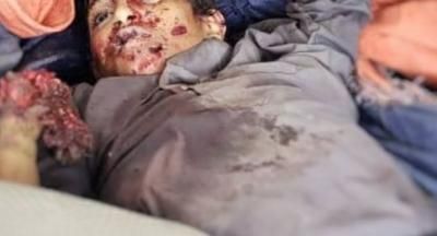 أخبار اليمن : انفجار عنقودية يودي بحياة طفل في صعدة