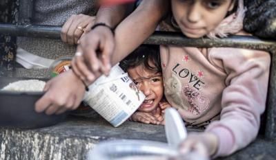 أخبار اليمن : الأونروا: طفل من بين 3 يعاني سوء تغذية حاد في غزة