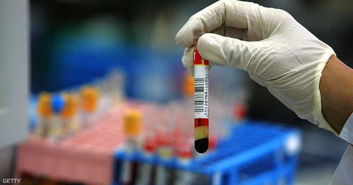 العالم اليوم - 6 اختبارات دم ضرورية تكشف أسرار صحتك
