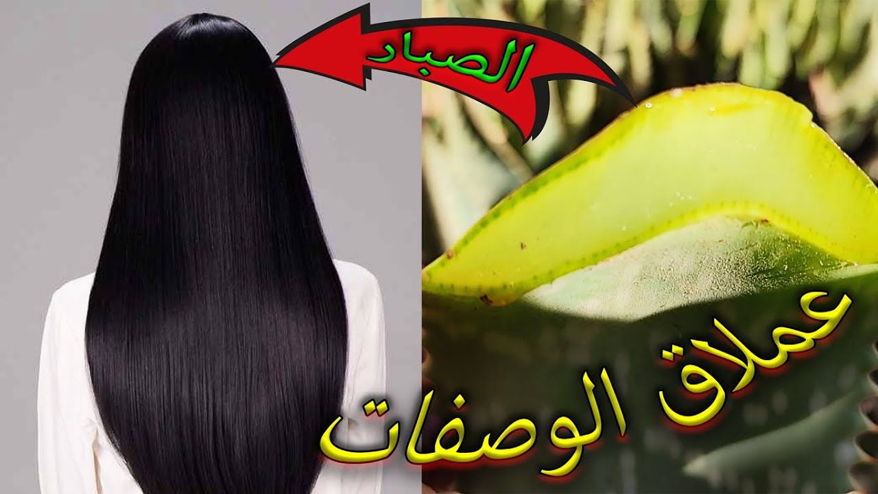 ماسكات جل الصبار لتنعيم شعرك.. تخلصي من قشرة الشعر واقضي على التساقط نهائيًا