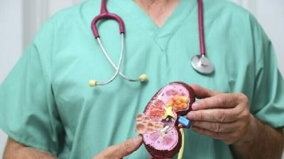 إليكم أسباب تكوين حصى الكلى