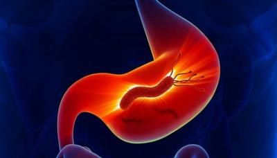 أخبار اليمن : نصائح غذائية لمكافحة التهاب المعدة