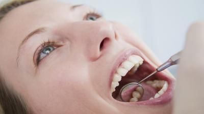 لون الفم مؤشر إلى حالات صحية مقلقة!