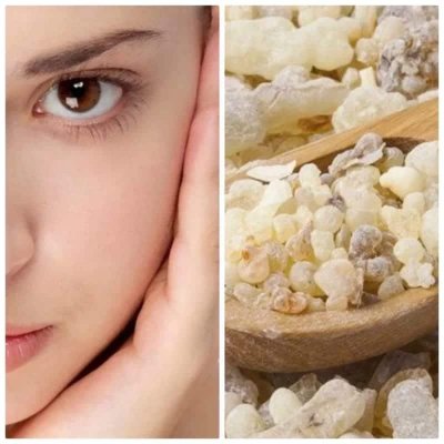 "مكون سحري في منزلك هيزيل التجاعيد".. وصفة منزلية لشد البشرة ستعيدك إلى عمر ال 20 في أيام معدودة