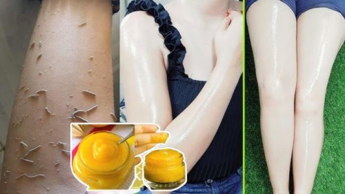 «وداعاً للكلف والبثور والبقع» .. معجزة الكركم والنشأ الجبار يقضي الكلف والبقع والجلد الميت ويجعل البشرة مشرقة .(طريقة التحضير)!