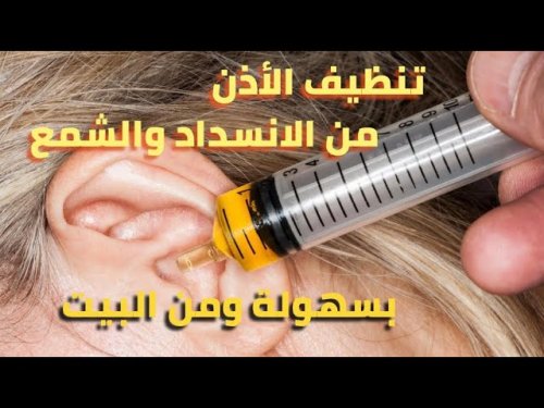 «مش هتحتاح لدكتور تاني خلاص».. طريقة جهنمية لإزالة الشمع من الأذن نهائيا بدون ألم في المنزل .. هتعملها بنفسك في 3 دقائق بس!!