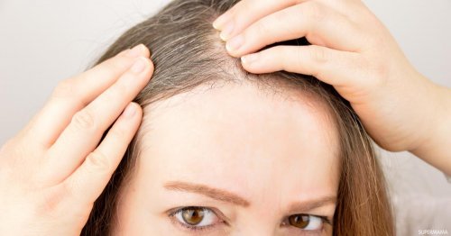 وصفة الفازلين المنزلية لعلاج شيب الشعر المبكر بدون رجعة انسي الشعر الأبيض بدون صبغات