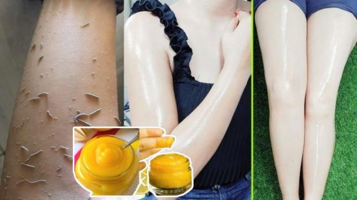 «وداعاً للكلف والبثور والبقع» .. معجزة الكركم والنشأ الجبار يقضي الكلف والبقع والجلد الميت ويجعل البشرة مشرقة .(طريقة التحضير)!