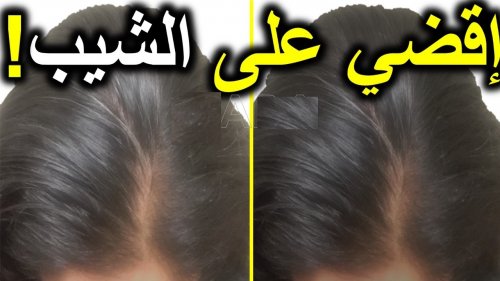 "هتخلي العجوزة صبية ".. وصفة سحرية و مجربة للقضاء على الشعر الأبيض بدون استخدام صبغات كيميائية .. هاتي معلقتين شاي ناشف وتعالي!!