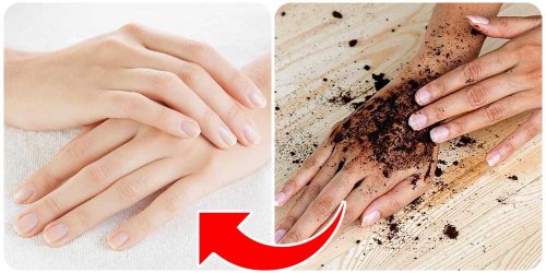 «للعرايس فقط».. طريقة عمل الدلكة السودانية لتفتيح وتبييض الوجه والجسم وازالة البقع والتصبغات..!! "هتنوري في فرحك"..!!