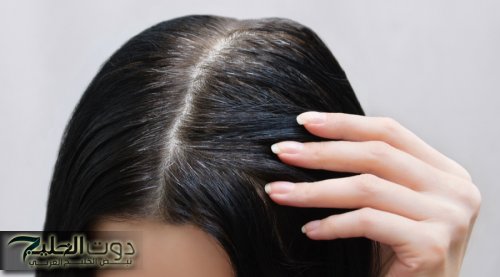 «انسى الشعر الابيض والشيب تماما..!!» وصفة للتخلص من شرب الشعر بمكونات طبيعيه وفعاله 100%.. هتشوفى الفرق بنفسك..!!
