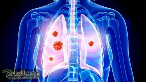 بقيت منتشرة جدًا.. أطباء يحذروا من عادة يومية يفعلها ملايين المصريين تؤدي للوفاة فورًا