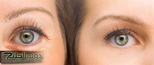 3 وصفات طبيعية للتخلص من تجاعيد البشرة هتصفي بشرتك وتنعمها وهترجعي كأنك شباب