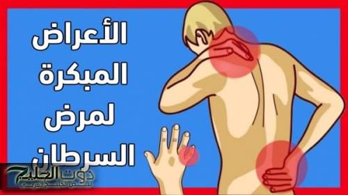 متجيش تقول معرفش .. احذر قبل فوات الأوان هذه الأعراض الخطيرة إذا ظهرت عليك فهي إشارة لـ إصابتك بمرض السرطان .. يجب أن تقوم بهذا الأمر فوراً