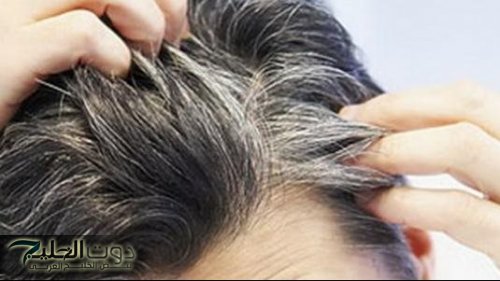 قابليني لو لمحتي شعرة بيضة تاني؟!.. تعرفي على اسباب الشيب المبكر وكيفية التخلص منه!!!