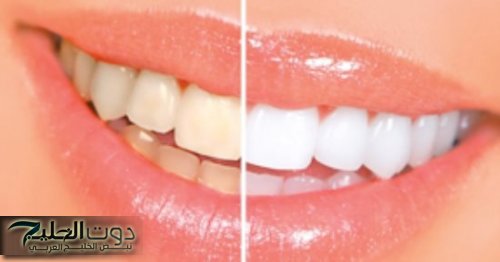 انتبه.. ما علاقة تغير لون الأسنان بمشاكل الكبد؟