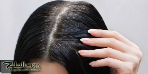 5 علامات تدل على أنك تعاني من نقص فيتامينات هامة بجسمك