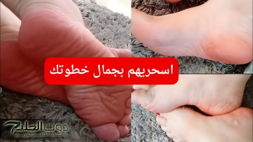«اسحريهم بجمال خطوتك ».. طريقة جهنمية للقضاء على التشققات في الكعبين وازالة الجلد الميت في غضون ثواني .. ما تروحيش كوافير تاني..!!