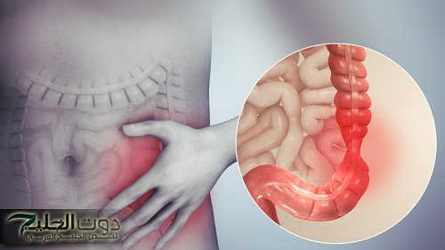 "عشبة سحرية في مطبخك تنظف القولون في دقائق.. اكتشاف شابة سعودية يثير الدهشة!"