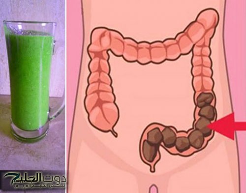 وصفات طبيعية لتطهير القولون...متوفرة بكل بيت يخرج الفضلات الصلبة و والرواسب و يطرد الروائح من داخلك ويخفف بطنك كثيراً!