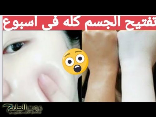 مفعوله كالسحر.. كريم من الصيدلية قنبلة لتبييض البشرة 10 درجات وإزالة التجاعيد والبقع الداكنة في 3 دقائق