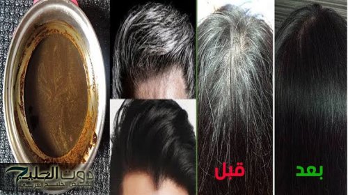 «بشوية حنة فقط..!!» تعالي اقولك على خلطة عبقرية هتخلصك من الشيب نهائيا بدون رجعة وبدون صبغه او تكاليف.. هترجعي شباب من تاني لو كنت 70 سنة..!!