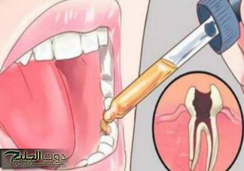 هتختفي في دقيقتين.. وصفة سحرية للتخلص من آلام الأسنان بمكونات طبيعية 100%